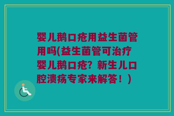 婴儿鹅口疮用益生菌管用吗(益生菌管可治疗婴儿鹅口疮？新生儿口腔溃疡专家来解答！)